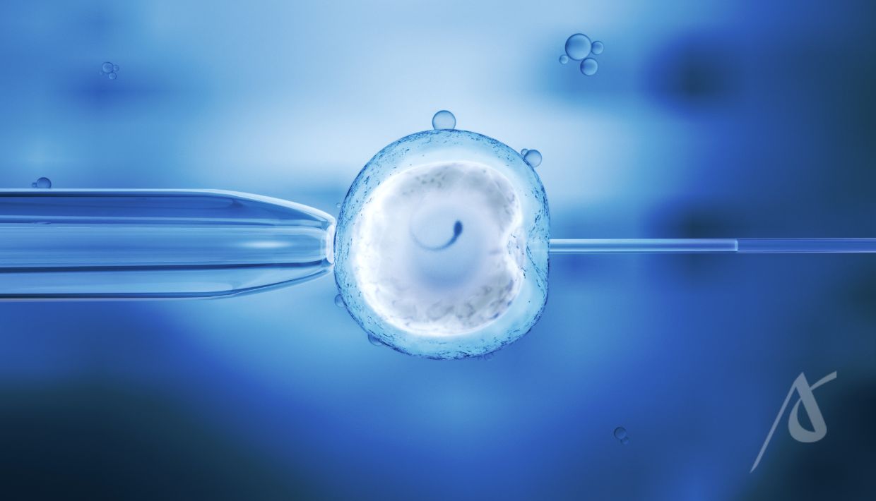 Fertilização in vitro com ICSI Fertilização in vitro com ICSI