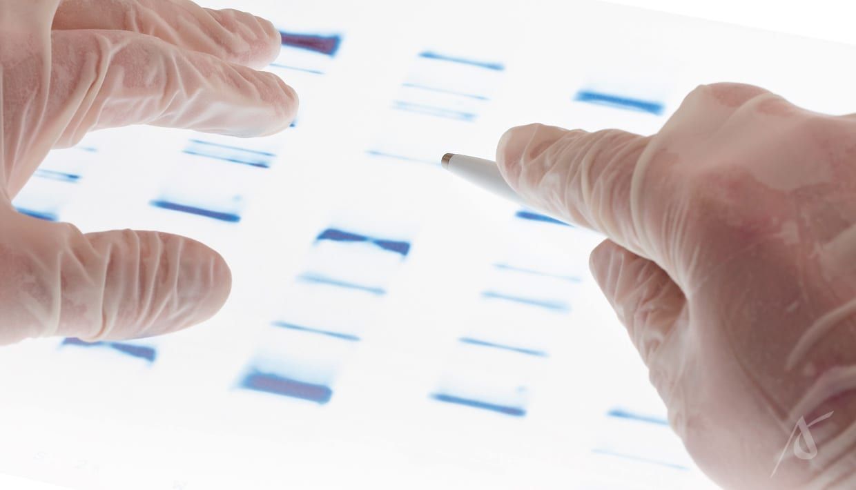 Teste genético pré-implantacional (PGT)